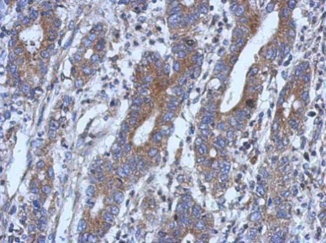 100uL Polyclonal antibody, NSUN4, host r