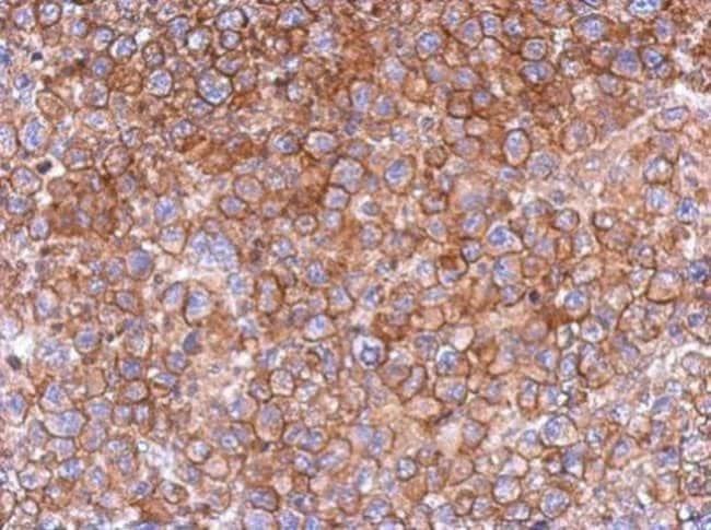 100uL Polyclonal antibody, FCHO2, host r