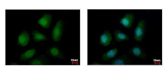 100uL Polyclonal antibody, PELO, host ra