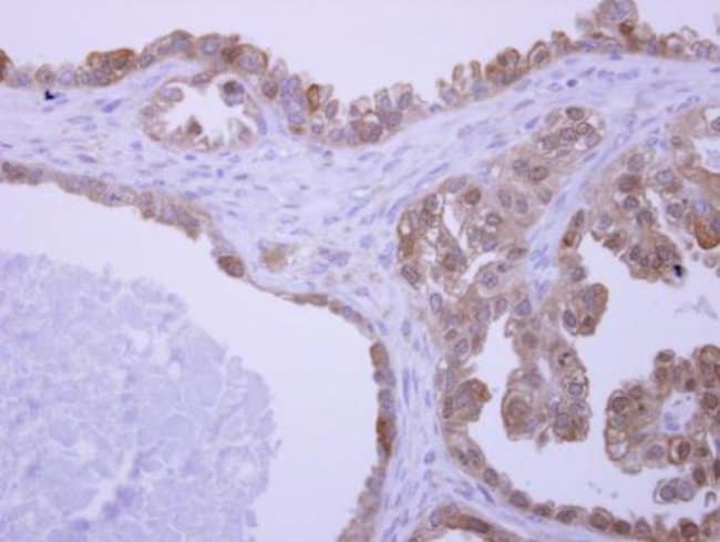 100uL Polyclonal antibody, UBAC1, host r