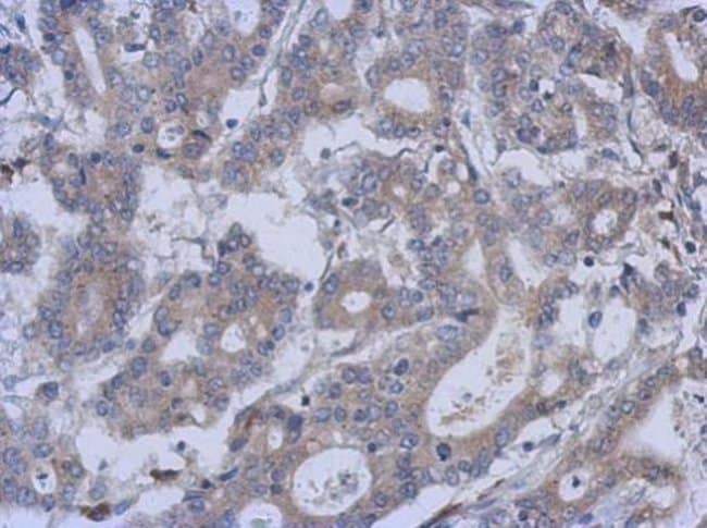 100uL Polyclonal antibody, FUZ, host rab