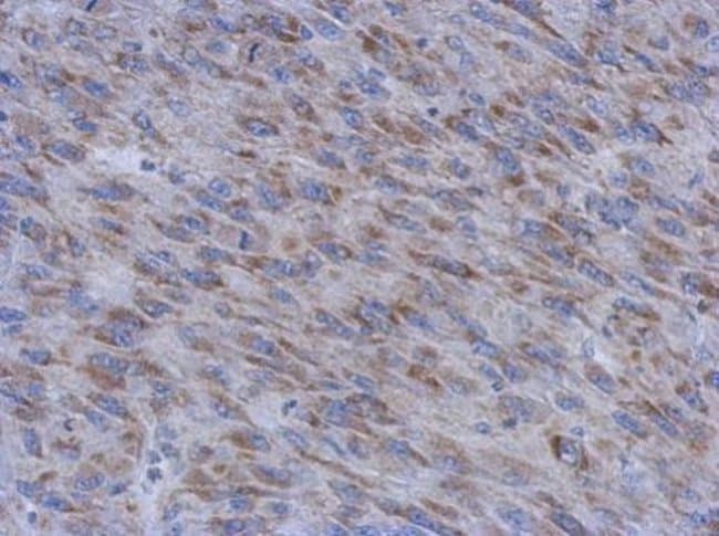 100uL Polyclonal antibody, MUM1L1, host