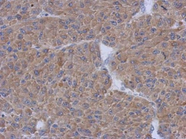 100uL Polyclonal antibody, CCDC17, host