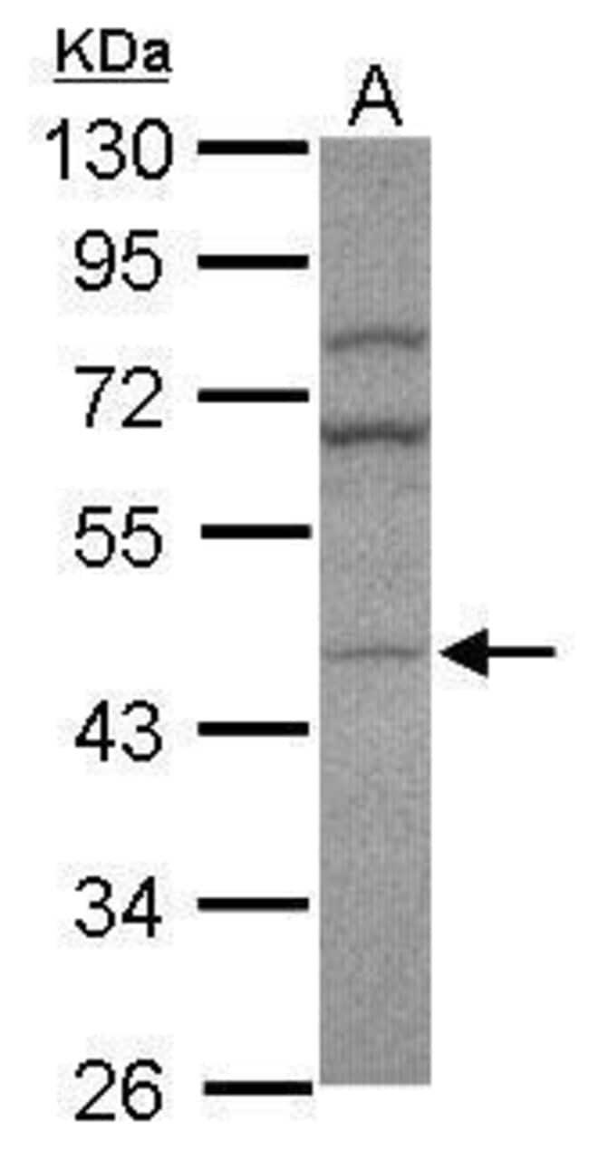 100uL Polyclonal antibody, AP1M2, host r