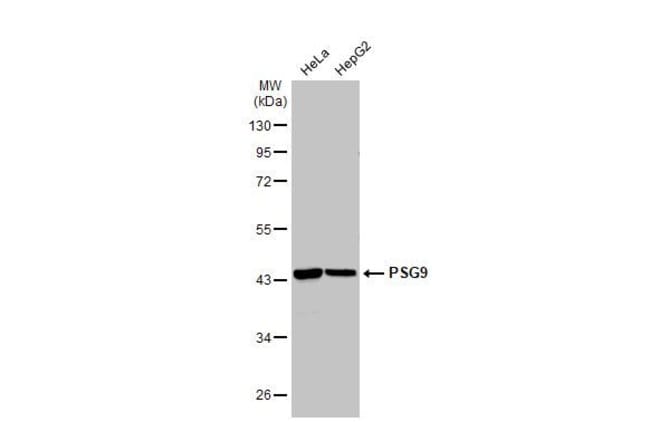 100uL Polyclonal antibody, PSG9, host ra