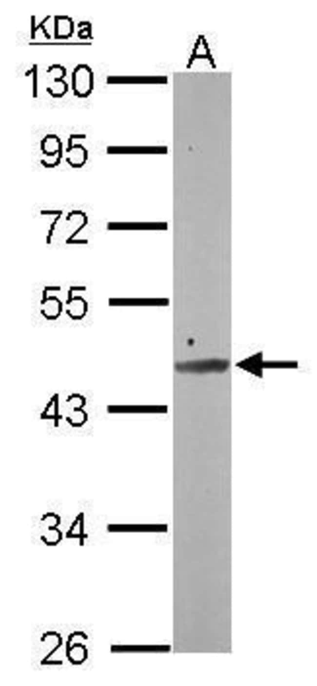 100uL Polyclonal antibody, SMCR7, host r