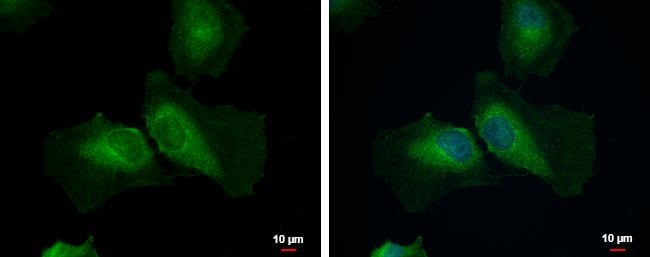100uL Polyclonal antibody, STAMBPL1, hos