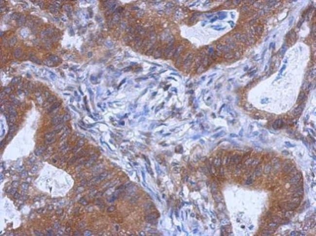 100uL Polyclonal antibody, WDR85, host r