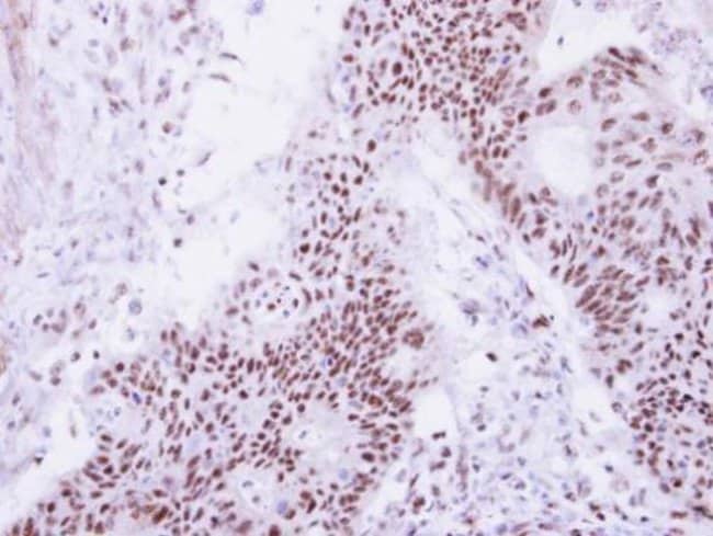 100uL Polyclonal antibody, DDX47, host r