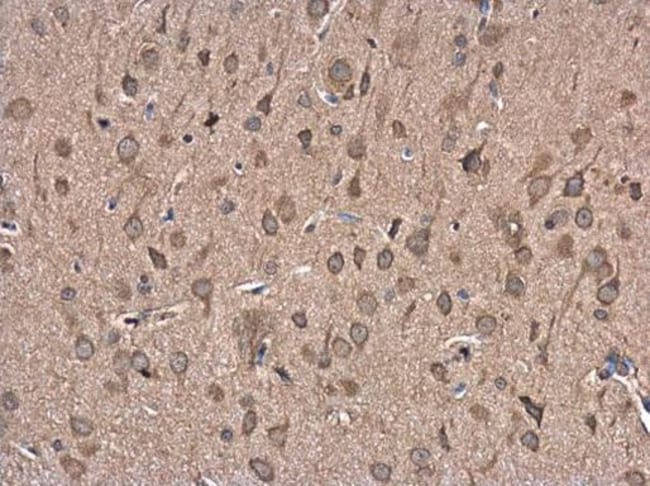 100uL Polyclonal antibody, FBXL16, host