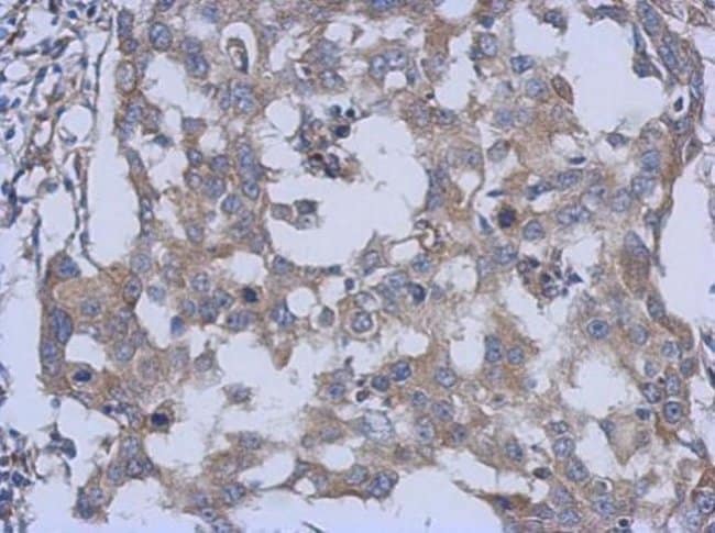 100uL Polyclonal antibody, PARS2, host r