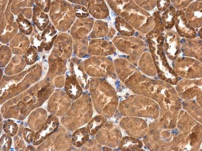 100uL Polyclonal antibody, RASGEF1A, hos