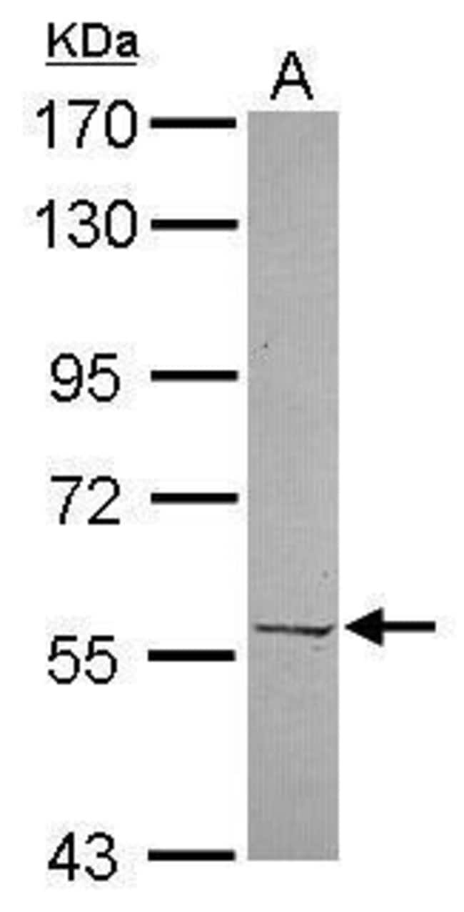 100uL Polyclonal antibody, PRPF4, host r