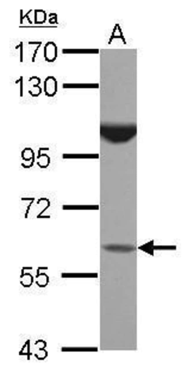 100uL Polyclonal antibody, BTBD16, host