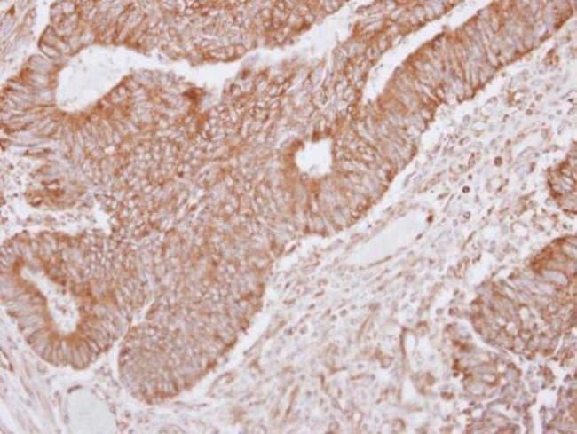 100uL Polyclonal antibody, LRRC1, host r