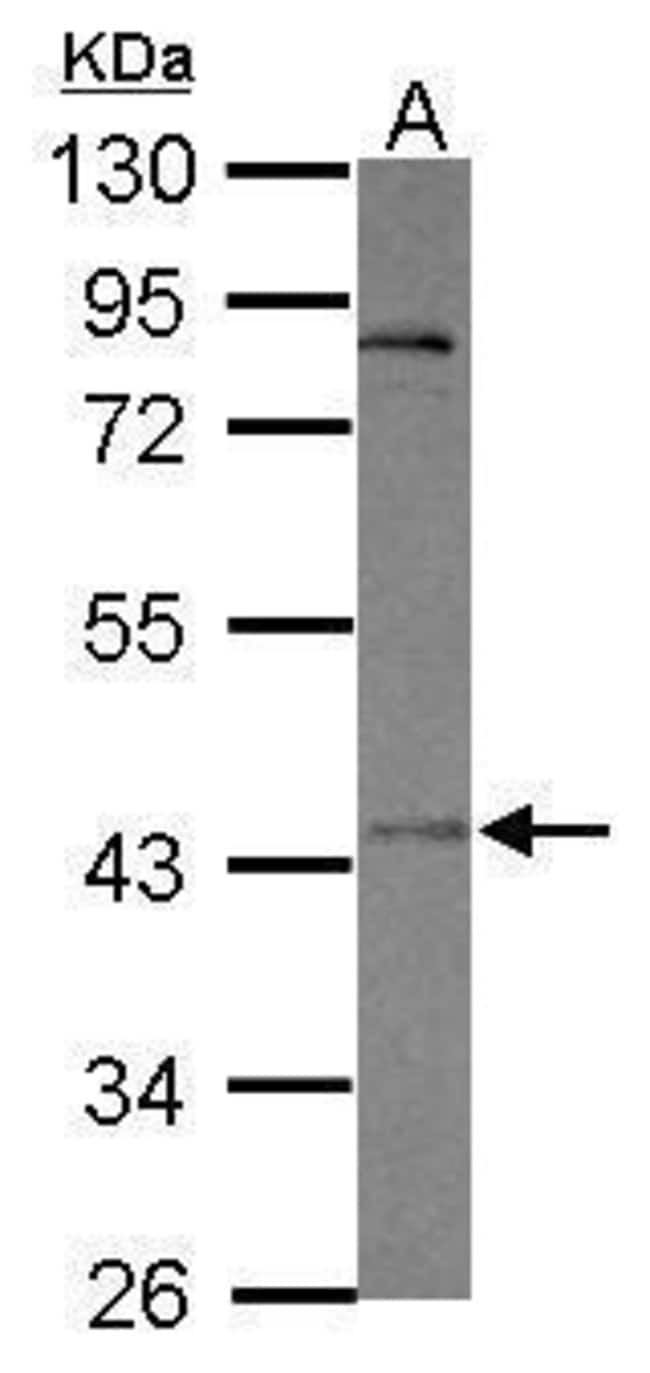 100uL Polyclonal antibody, OTUD5, host r