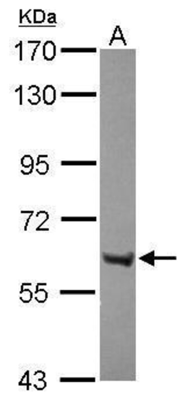 100uL Polyclonal antibody, ZNF642, host