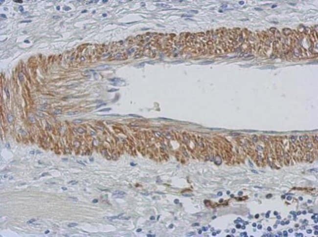 100uL Polyclonal antibody, CHST15, host