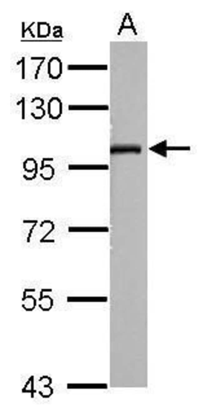 100uL Polyclonal antibody, SLC9A8, host