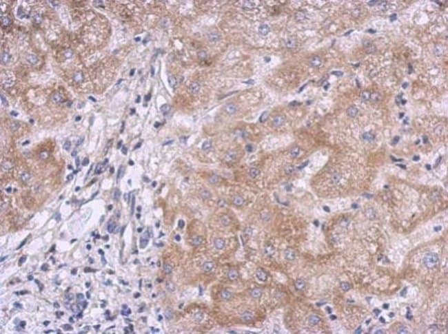 100uL Polyclonal antibody, KLHL21, host