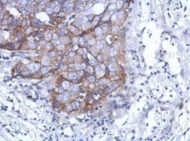 100uL Polyclonal antibody, DDX59, host r