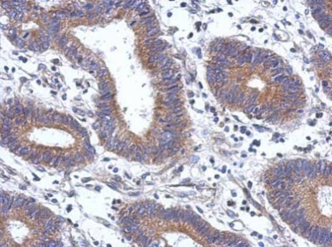 100uL Polyclonal antibody, ENTPD7, host