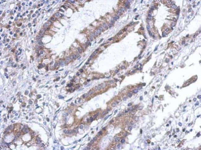 100uL Polyclonal antibody, PLA2G4F, host