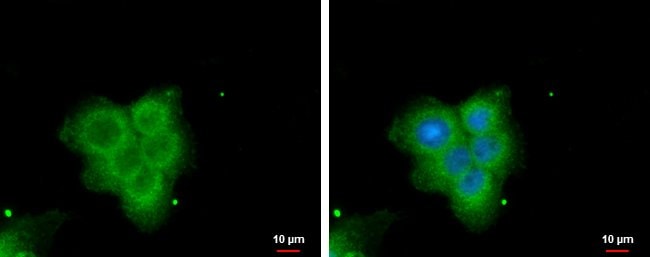 100uL Polyclonal antibody, PLA2G4F, host