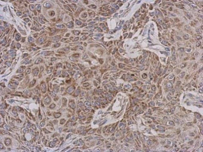 100uL Polyclonal antibody, TTLL12, host