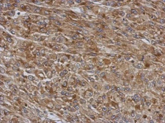 100uL Polyclonal antibody, TMCO3, host r
