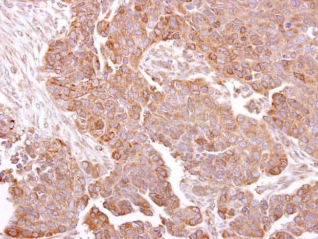 100uL Polyclonal antibody, metTL13, host