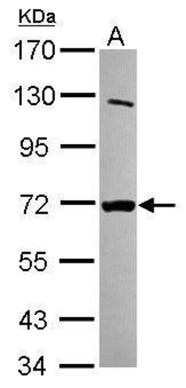100uL Polyclonal antibody, MTMR8, host r