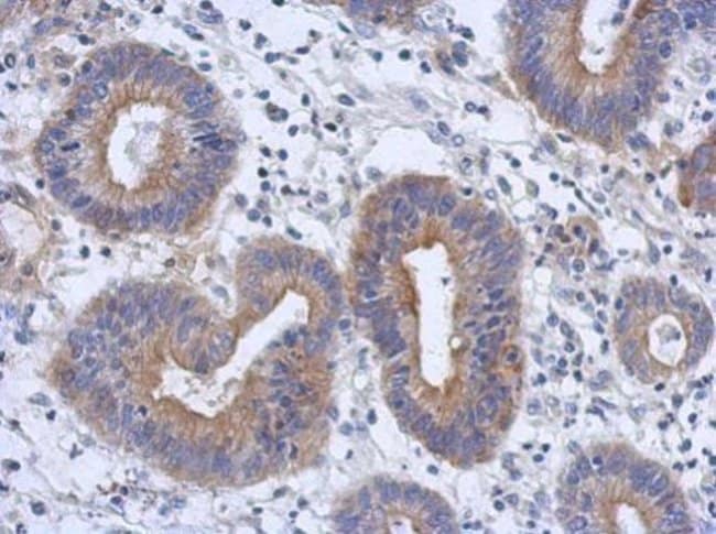 100uL Polyclonal antibody, RAB11FIP3, ho