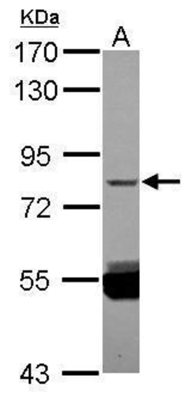 100uL Polyclonal antibody, ZNF280C, host