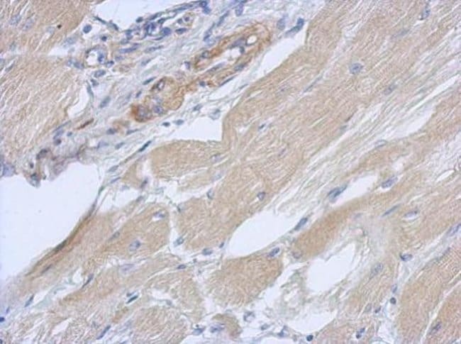 100uL Polyclonal antibody, OXR1, host ra