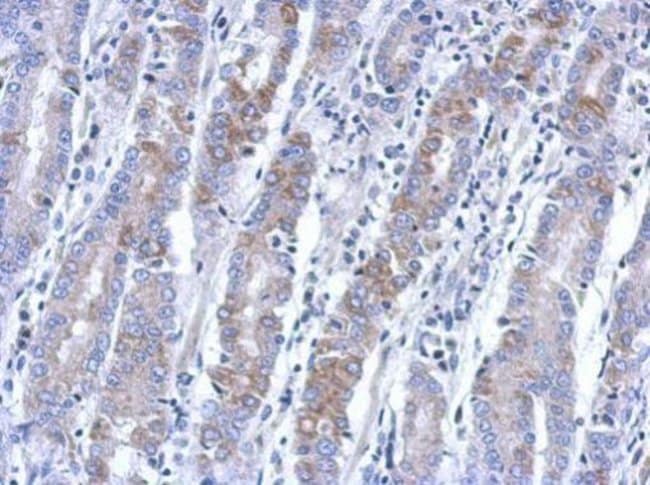 100uL Polyclonal antibody, BEND2, host r