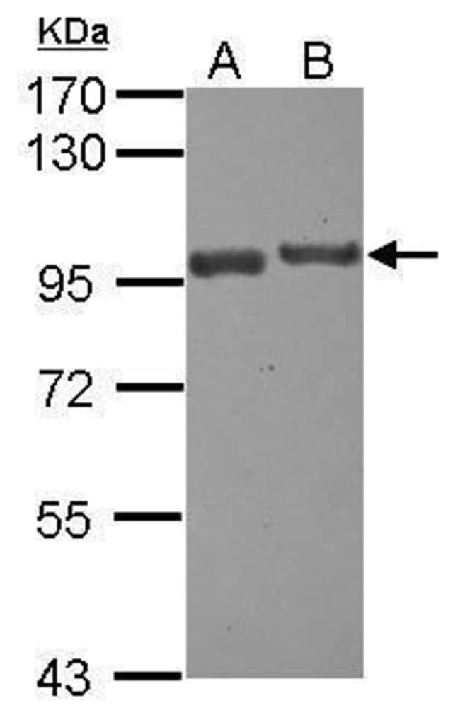 100uL Polyclonal antibody, USP6NL, host