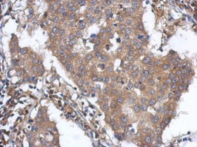 100uL Polyclonal antibody, ANKLE2, host