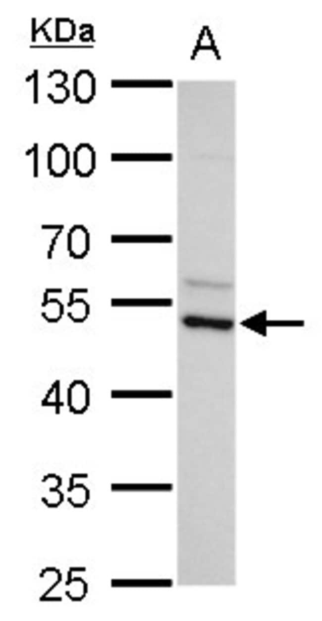 100uL Polyclonal antibody, ADC, host rab