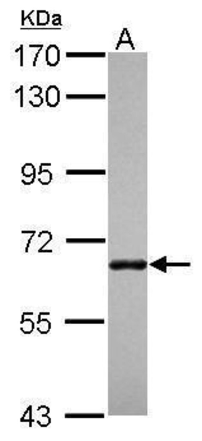 100uL Polyclonal antibody, ANKRD13B, hos