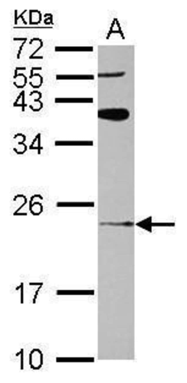 100uL Polyclonal antibody, ARL8A, host r