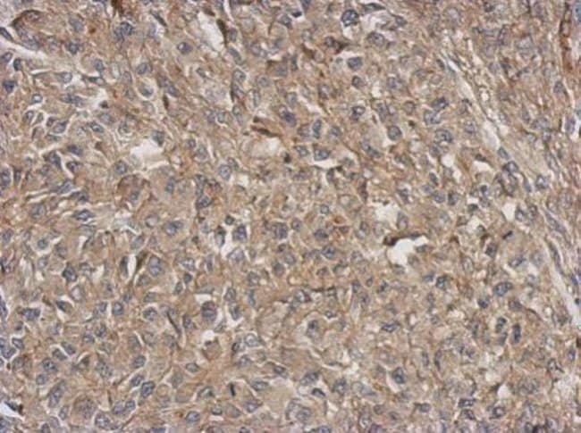 100uL Polyclonal antibody, ARPC5L, host