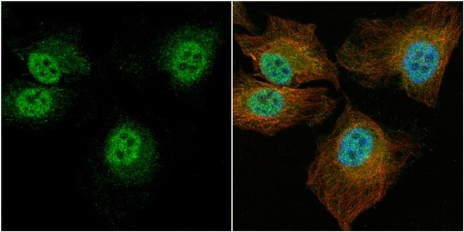 100uL Polyclonal antibody, CCDC14, host
