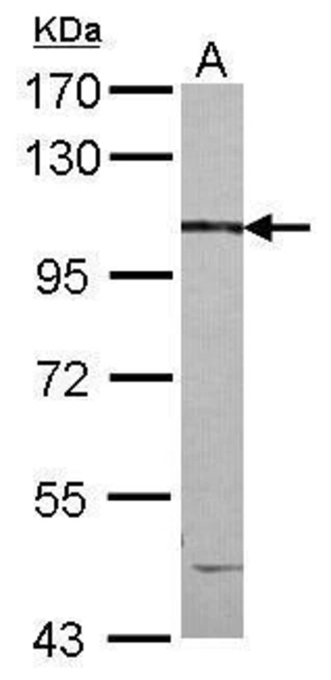 100uL Polyclonal antibody, CCDC147, host
