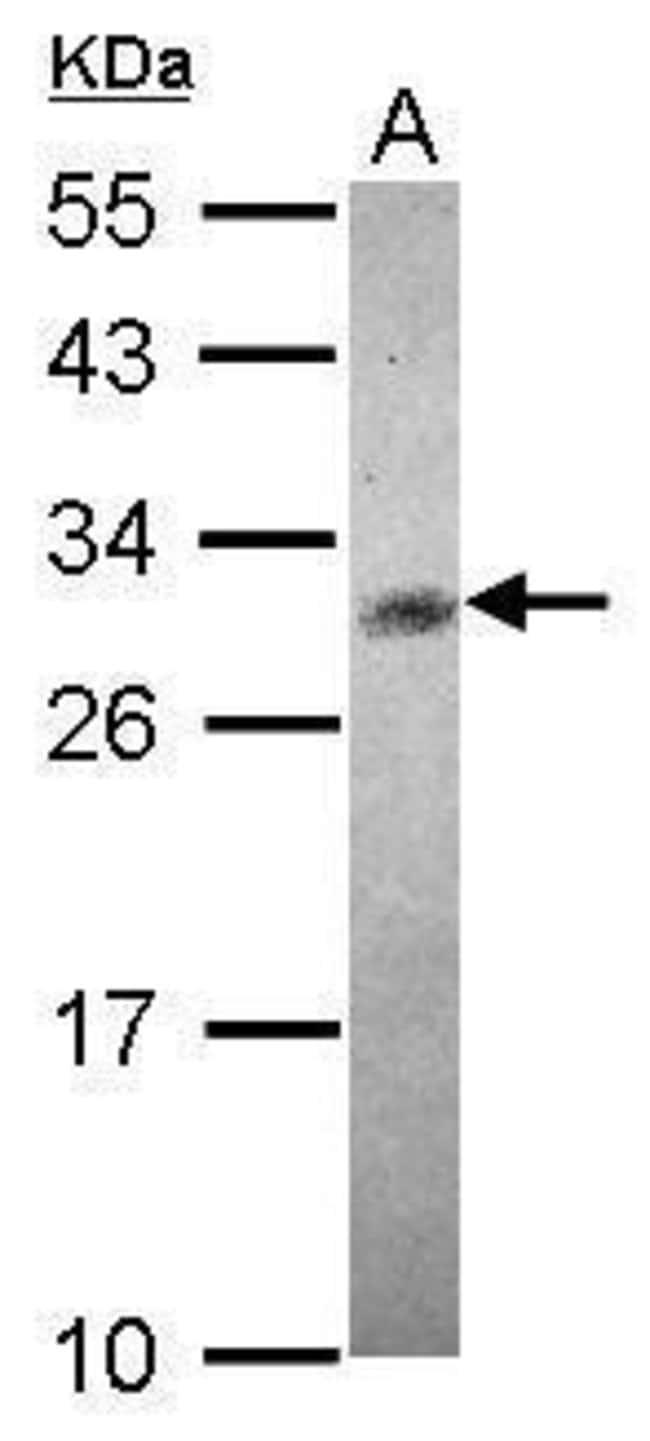 100uL Polyclonal antibody, CHAC1, host r