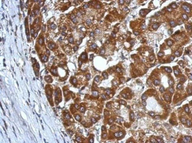 100uL Polyclonal antibody, CHST7, host r