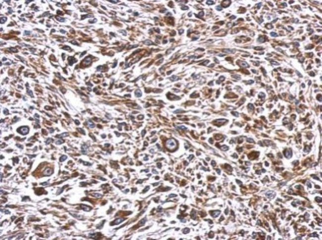 100uL Polyclonal antibody, ERLIN1, host