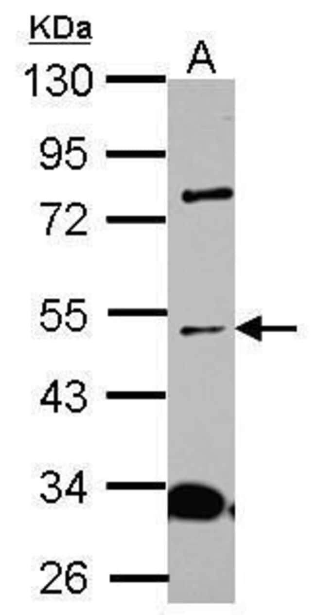 100uL Polyclonal antibody, ALS2CR15, hos