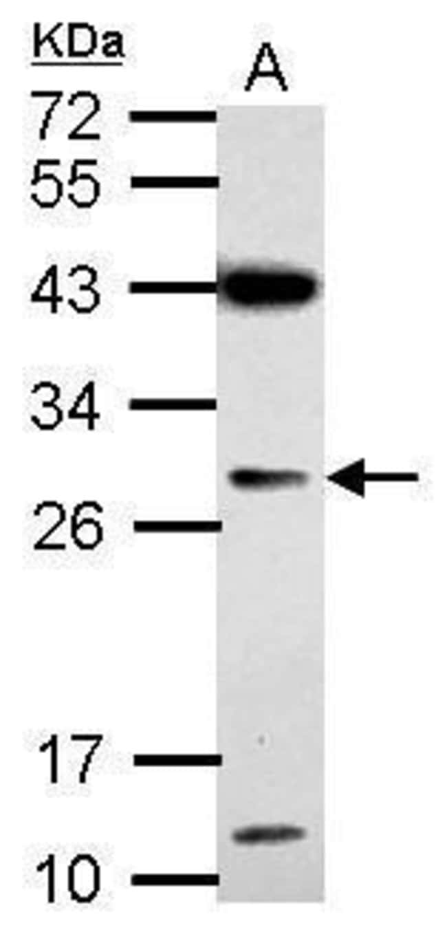100uL Polyclonal antibody, IMP4, host ra