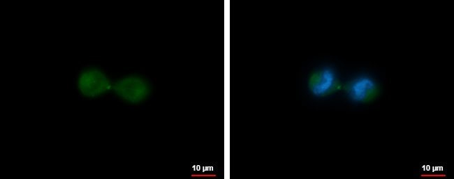100uL Polyclonal antibody, MKLP1, host r